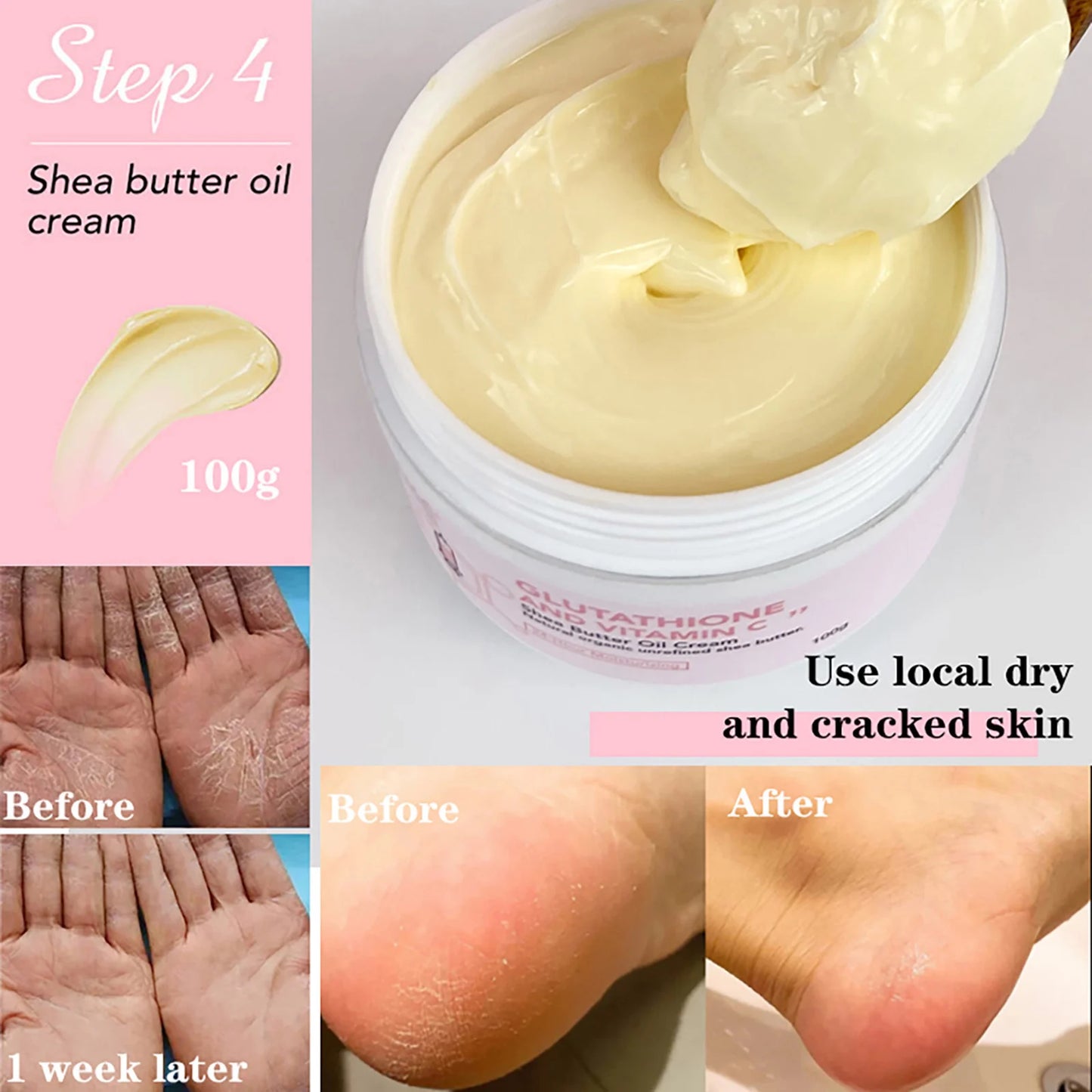 AILKE Whitening Glutathione Vitamin C Facial Lotion