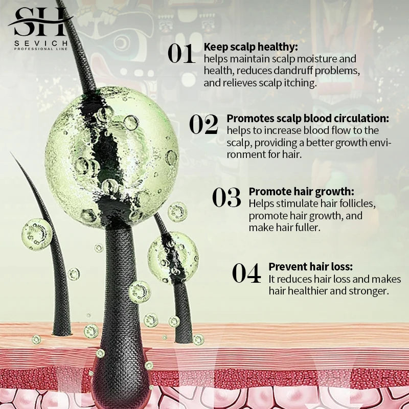 Sevich Ayurvedic Hair Growth Oil For Strong Roots And Growth